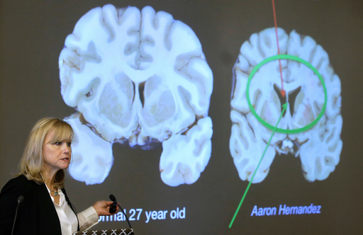 FILE - Ann McKee, director Boston University's center for research into the degenerative brain disease chronic traumatic encephalopathy, or CTE, addresses an audience on the school's campus Nov. 9, 2017 about the study of NFL football player Aaron Hernandez's brain, projected on a screen, behind right, in Boston. (AP Photo/Steven Senne, File) FILE - Ann McKee, director Boston University's center for research into the degenerative brain disease chronic traumatic encephalopathy, or CTE, addresses an audience on the school's campus Nov. 9, 2017 about the study of NFL football player Aaron Hernandez's brain, projected on a screen, behind right, in Boston. (AP Photo/Steven Senne, File)